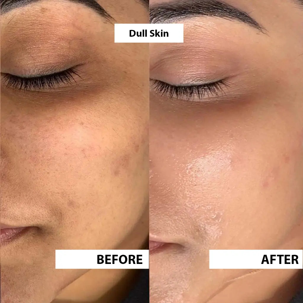 Skin Care Combo