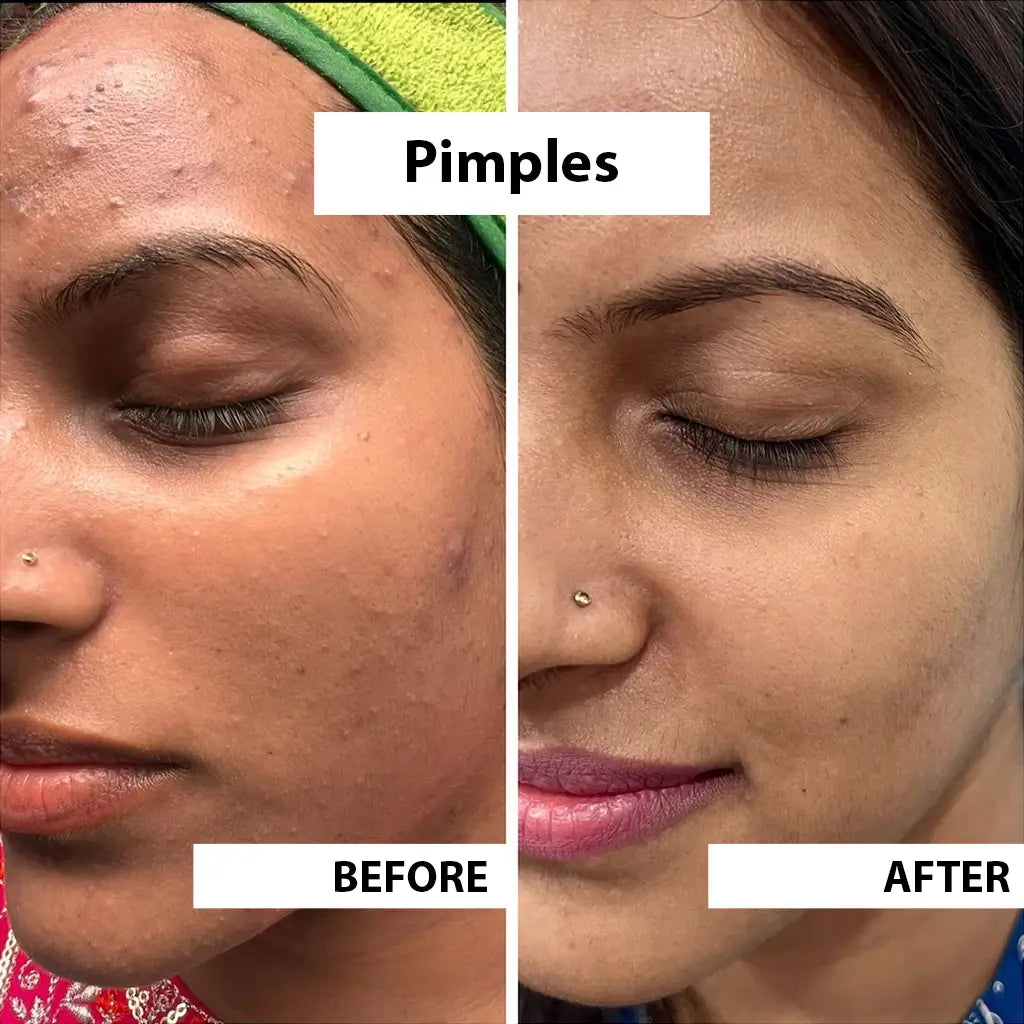 Skin Care Combo
